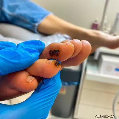 Podolog - Warszawa, Śródmieście | AliMedica - Gabinet Podologiczny